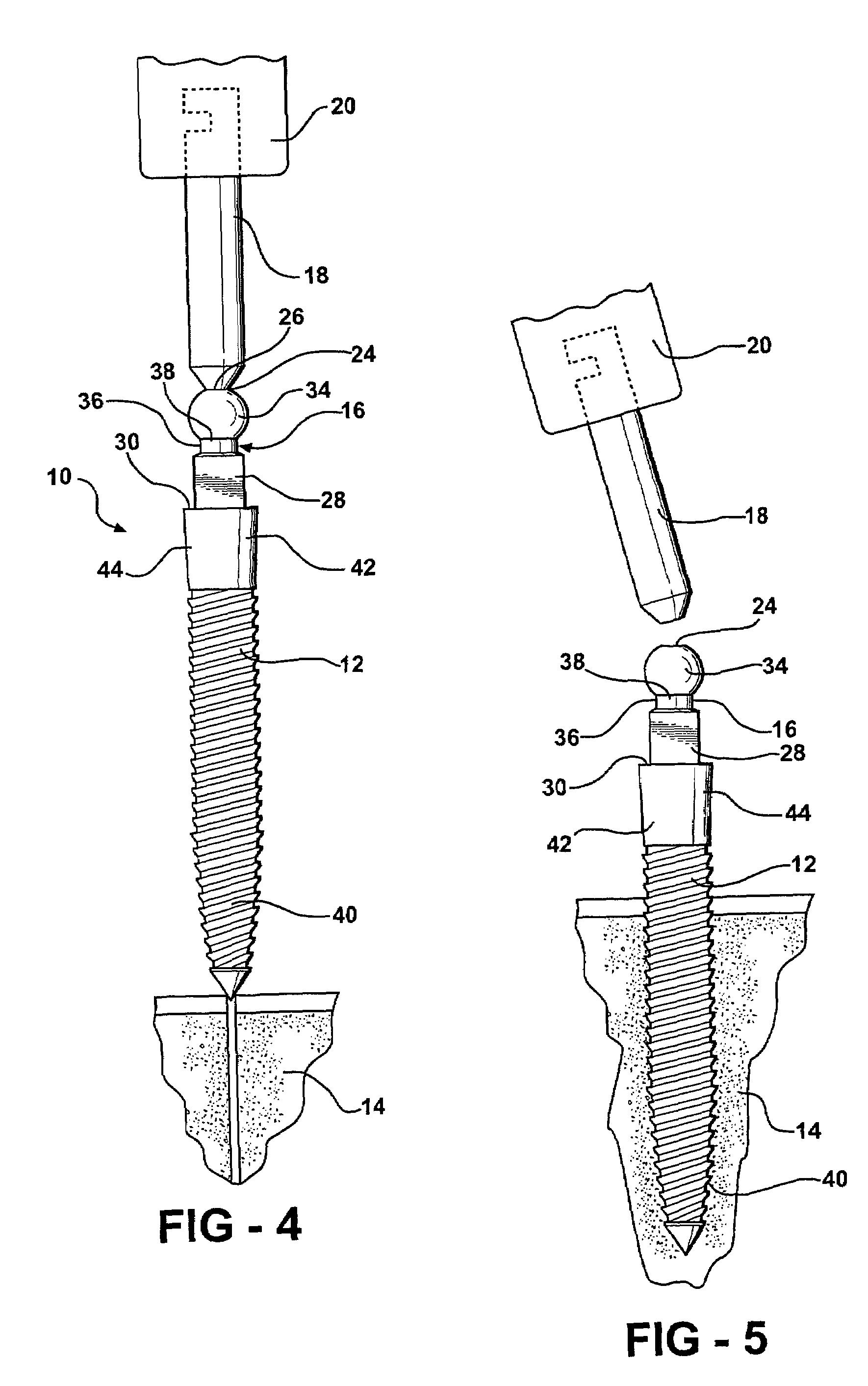 Prosthetic mounting device