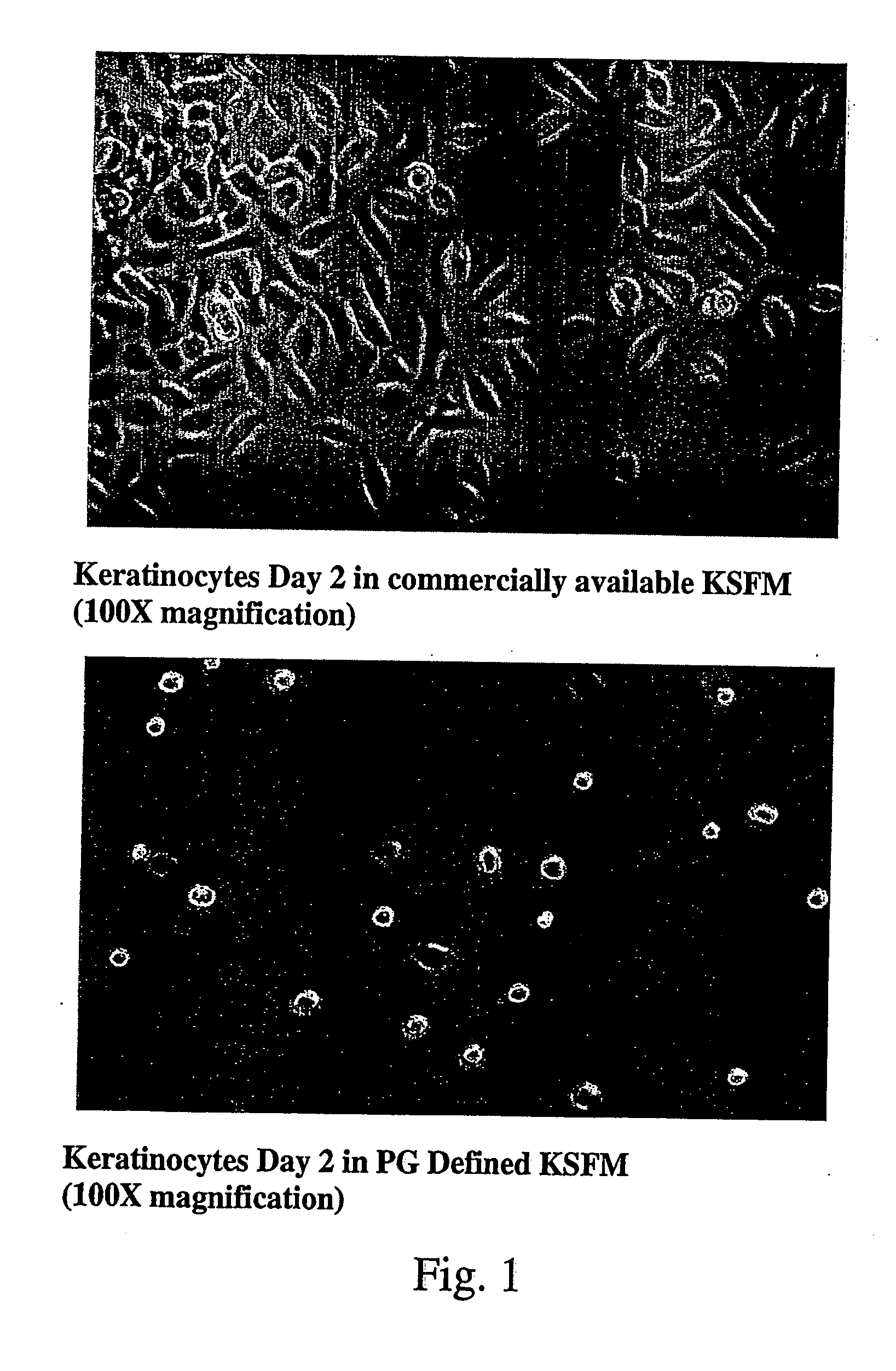 Method for culturing and expansion of mammalian undifferentiated epidermal kerainocytes exhibiting stem cell characteristics