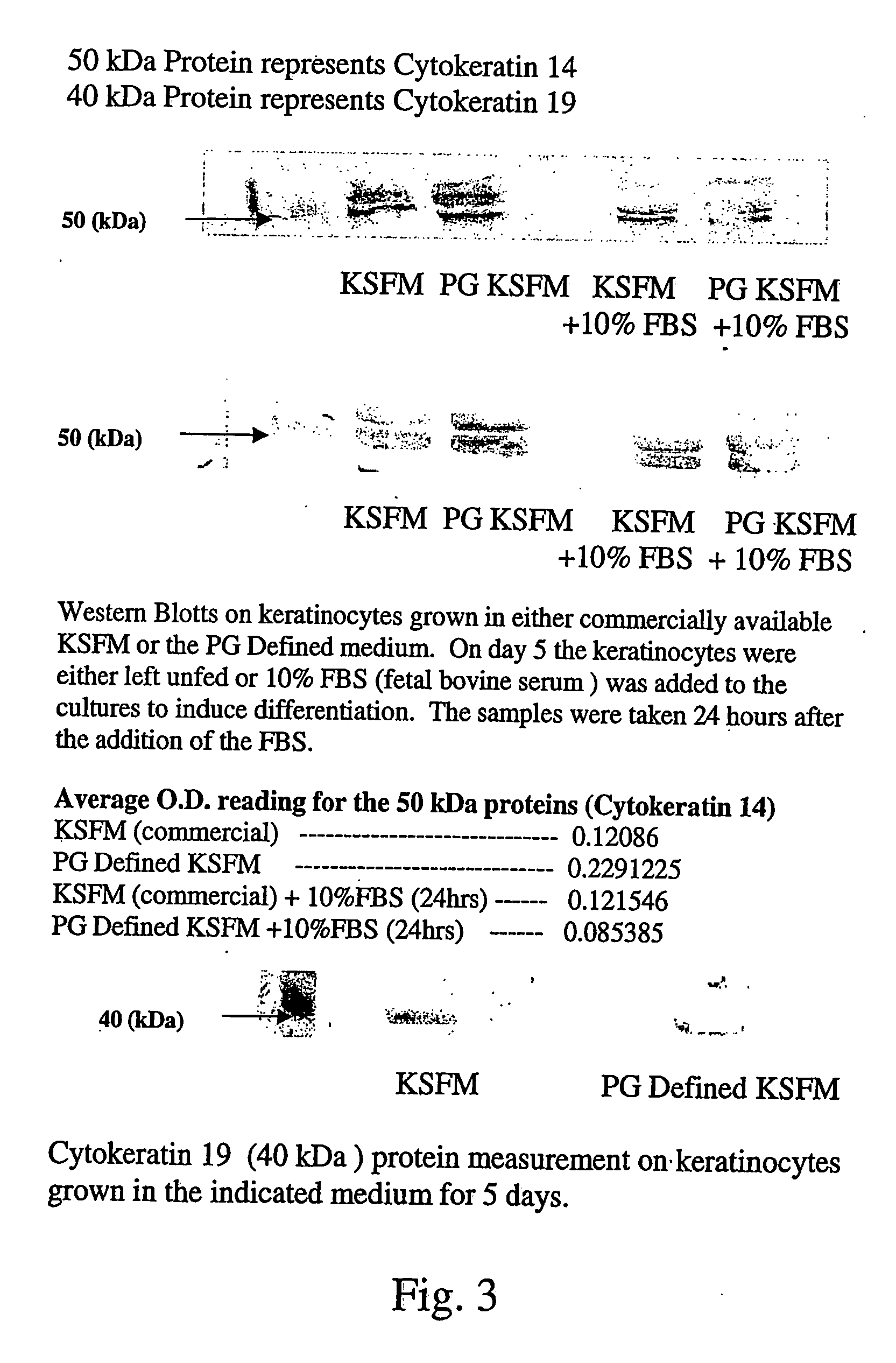 Method for culturing and expansion of mammalian undifferentiated epidermal kerainocytes exhibiting stem cell characteristics