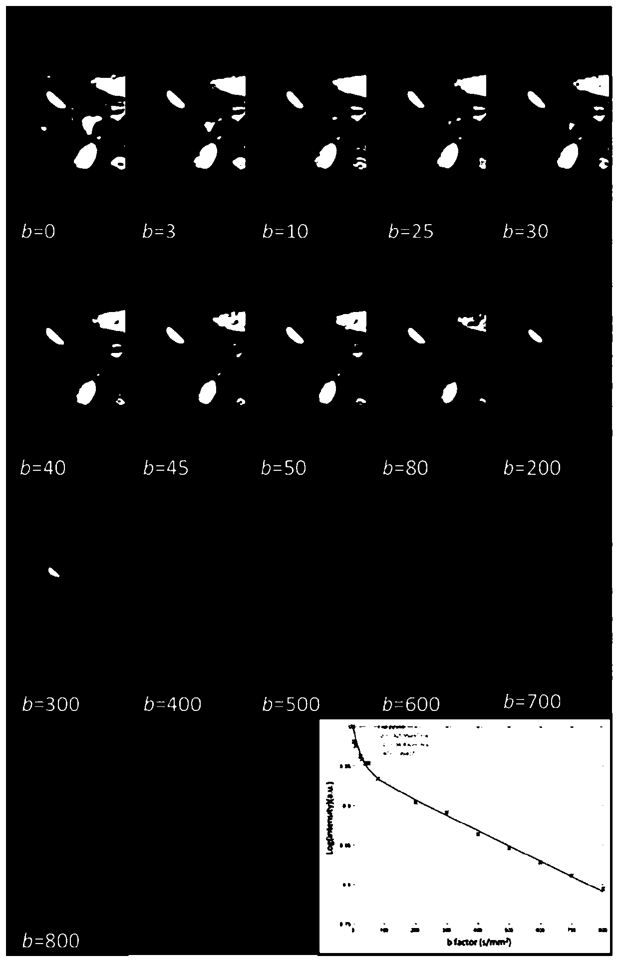 Signal processing method and device for intravoxel incoherent motion imaging and storage medium