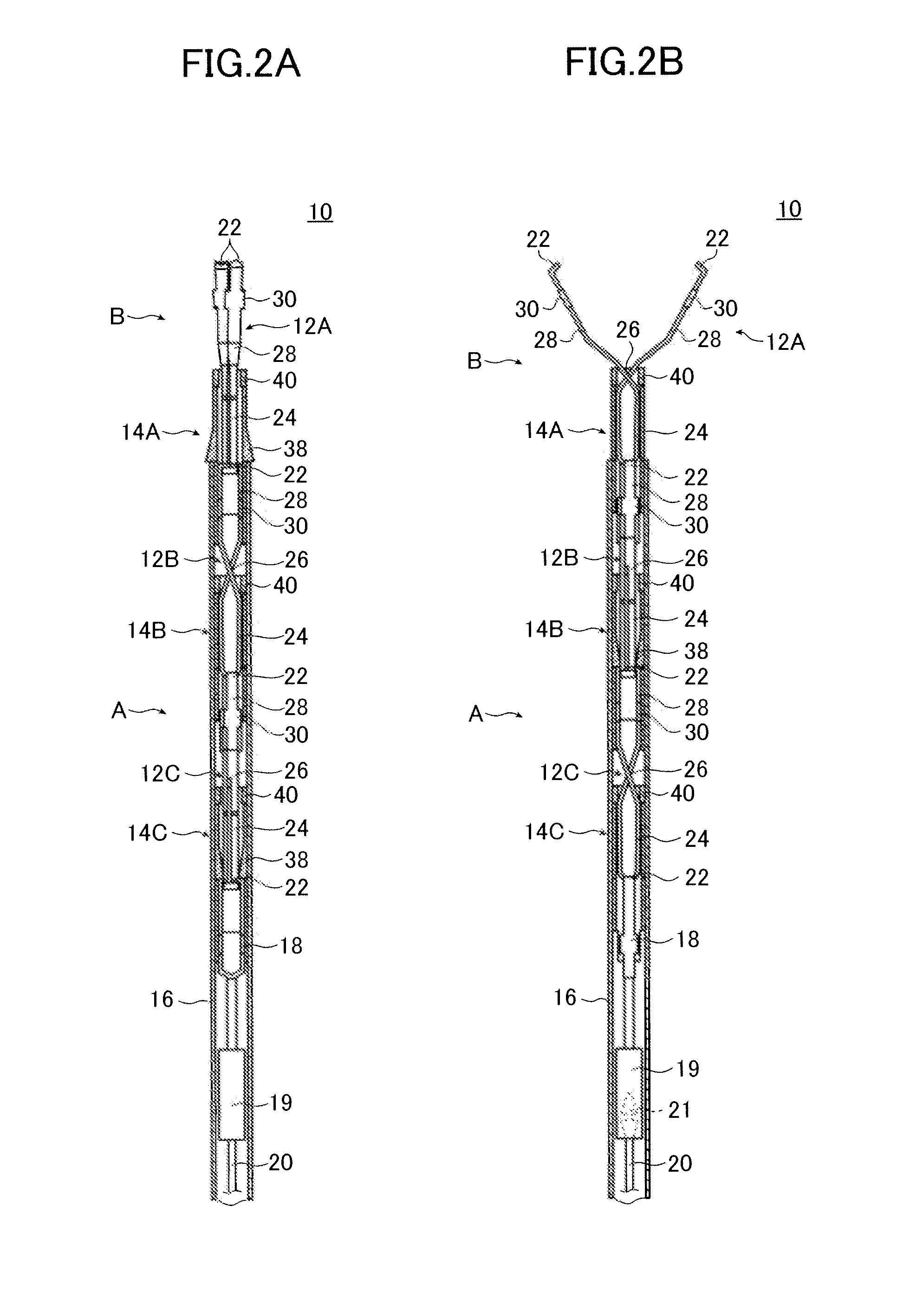 Repetitive clipping treatment device