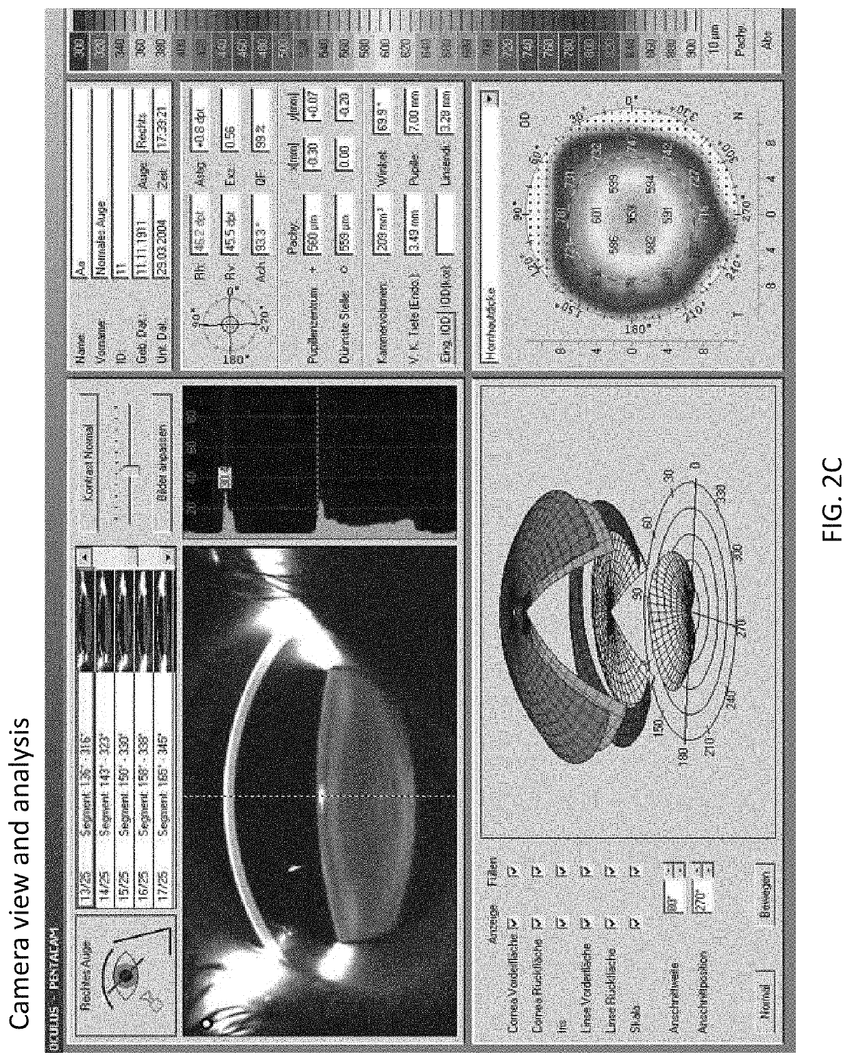 Ophthalmic surgery laser system and method for utilizing same for ophthalmic surgery