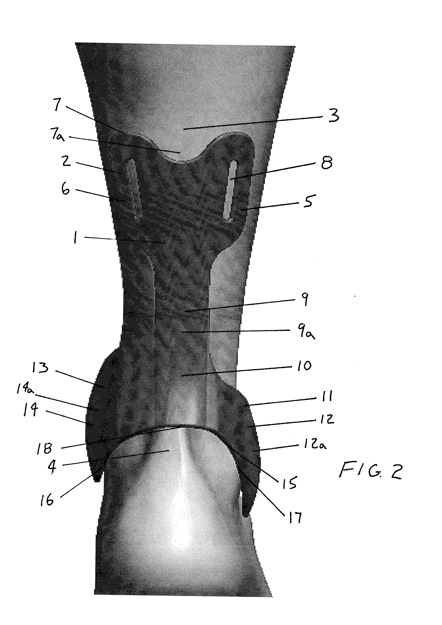 Achilles tendon protector