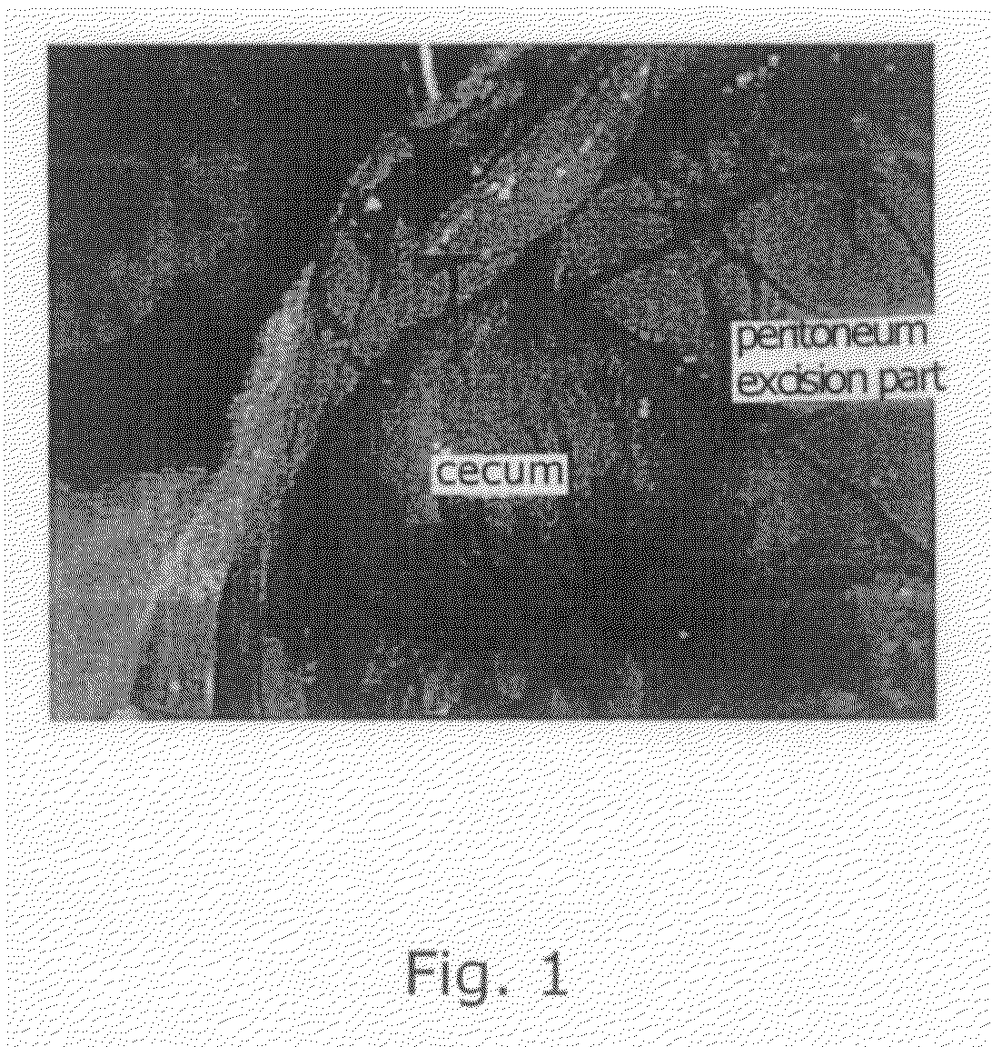 Adhesion-preventing material and process for preventing adhesion