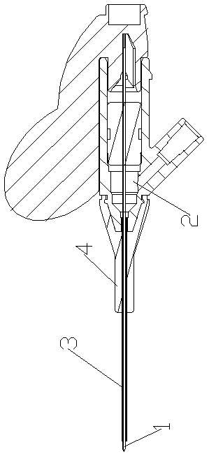 Disposable metal rivet-free indwelling needle