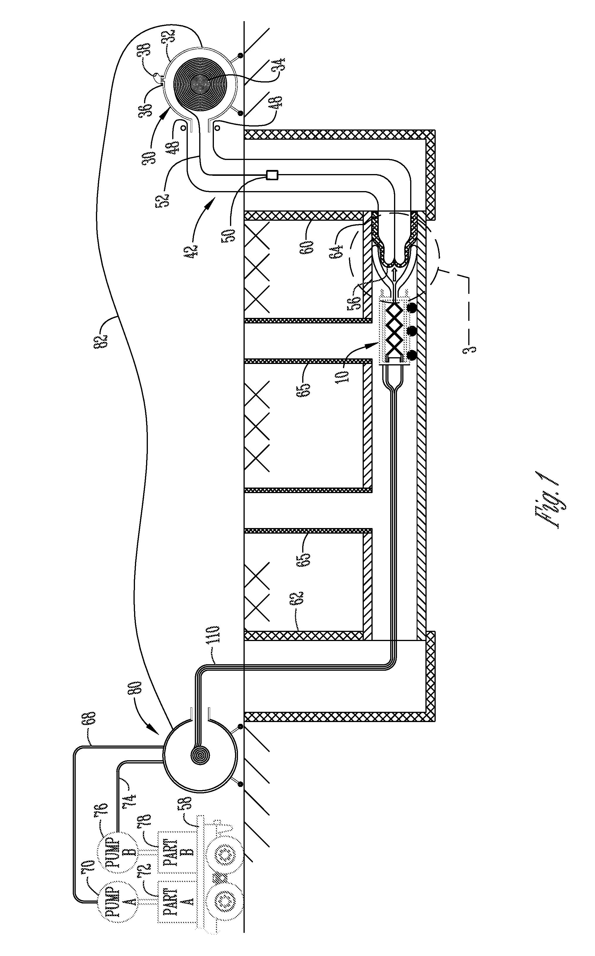 Apparatus and method for lining a pipe