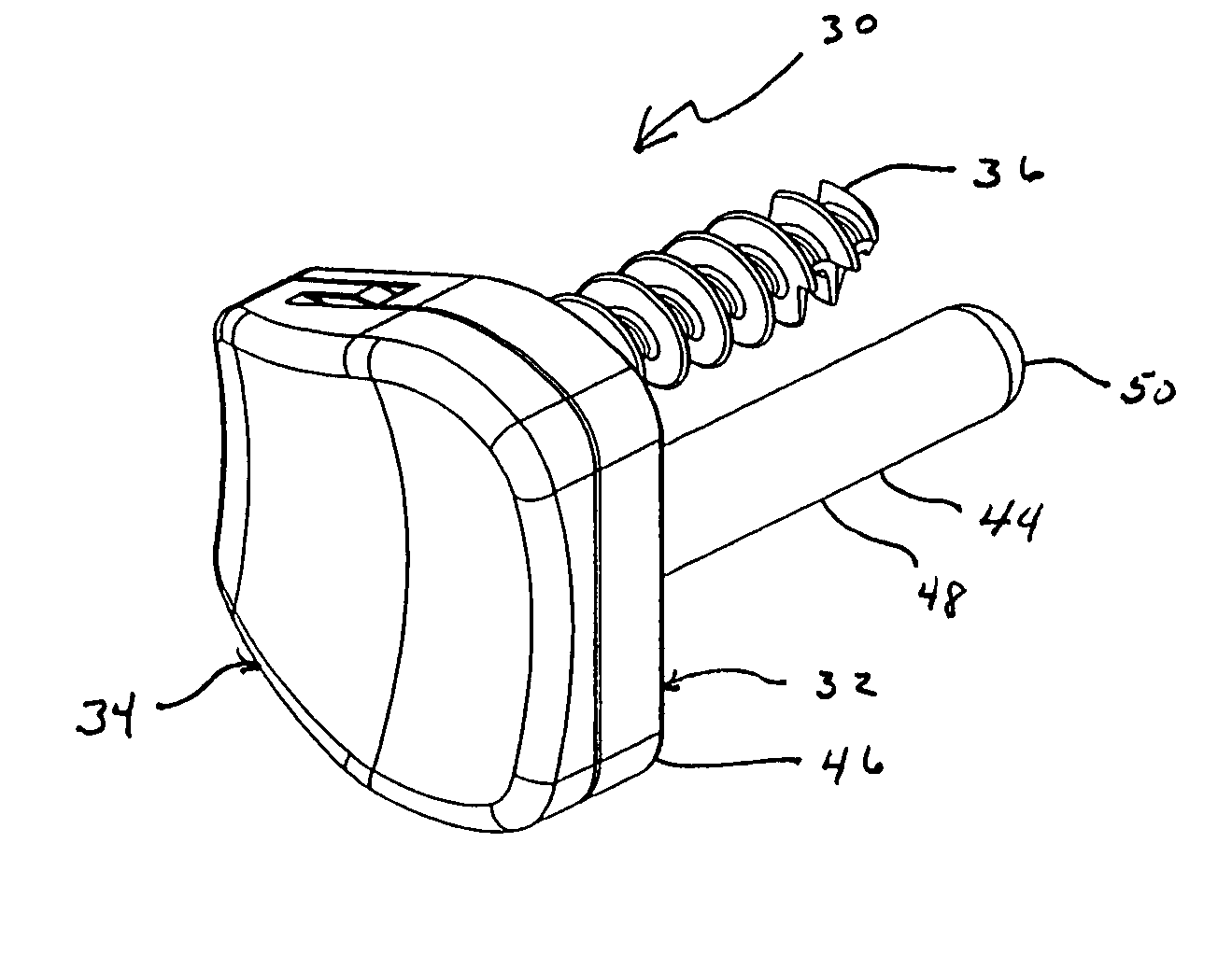 Sigmoid notch implant