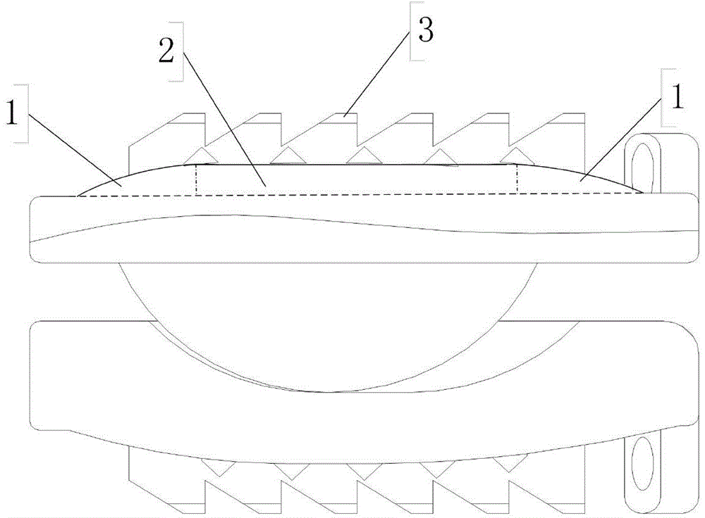 Cervical vertebra intervertebral disc prosthesis