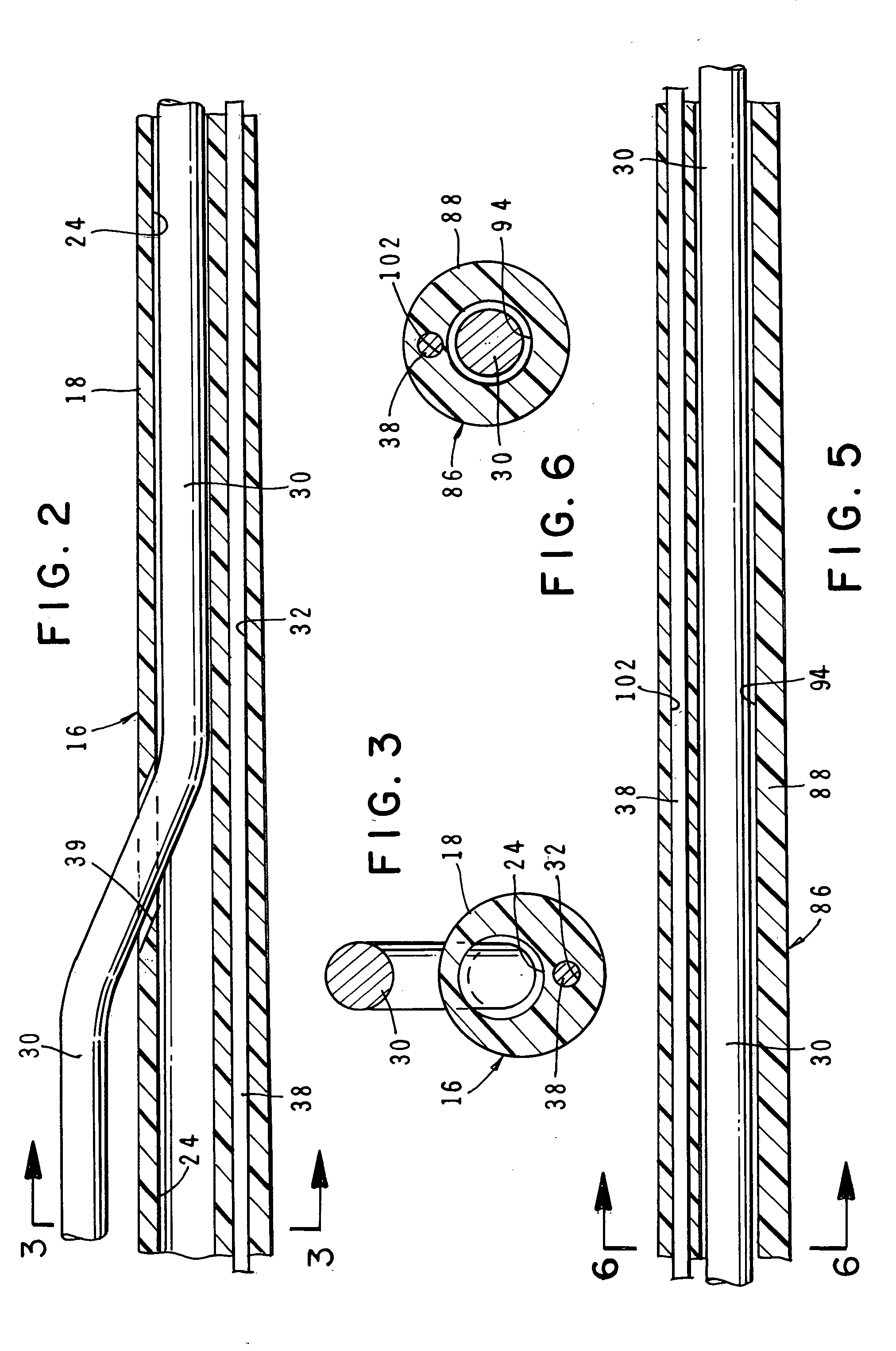 Intravascular catheter