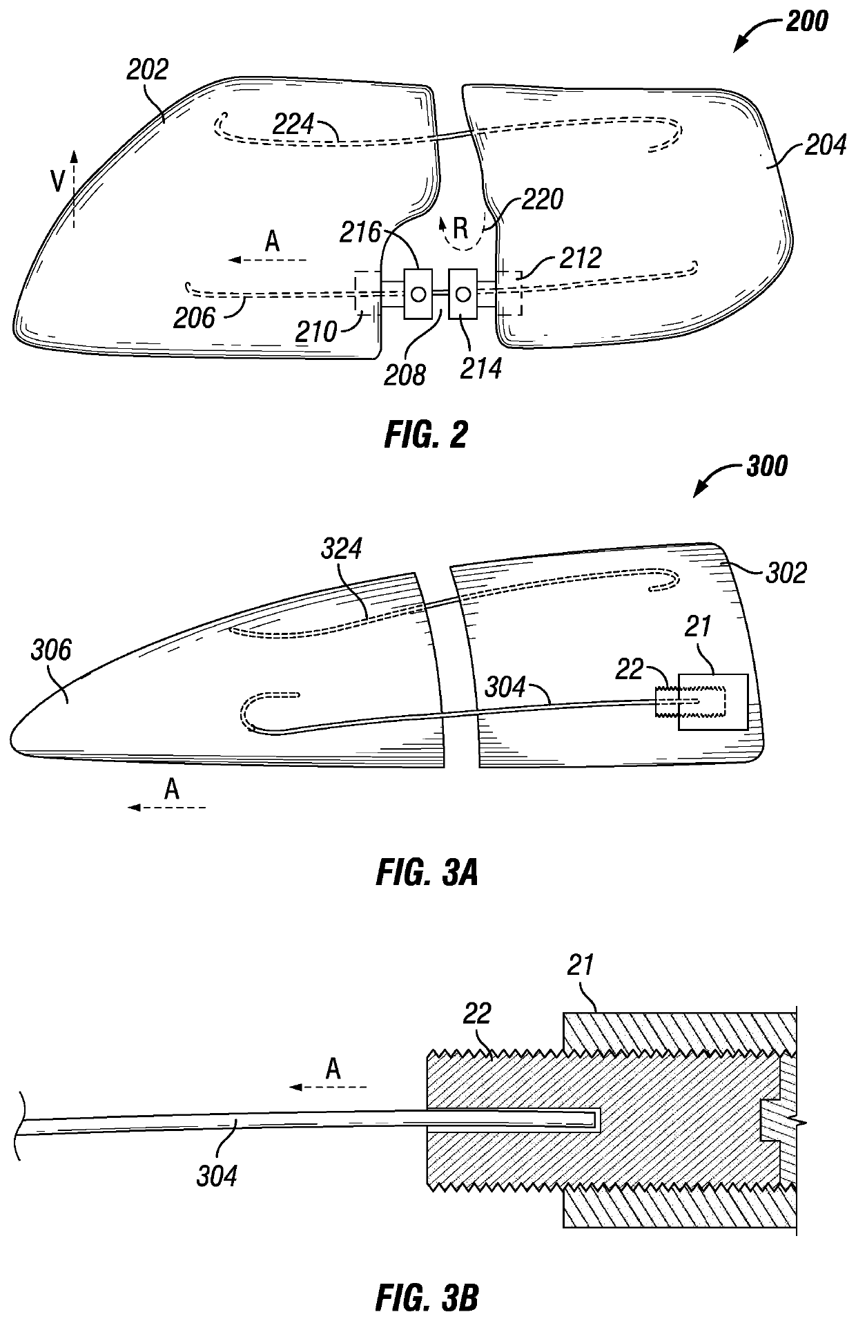 Dental system for symmetry of jaw, palate, and teeth