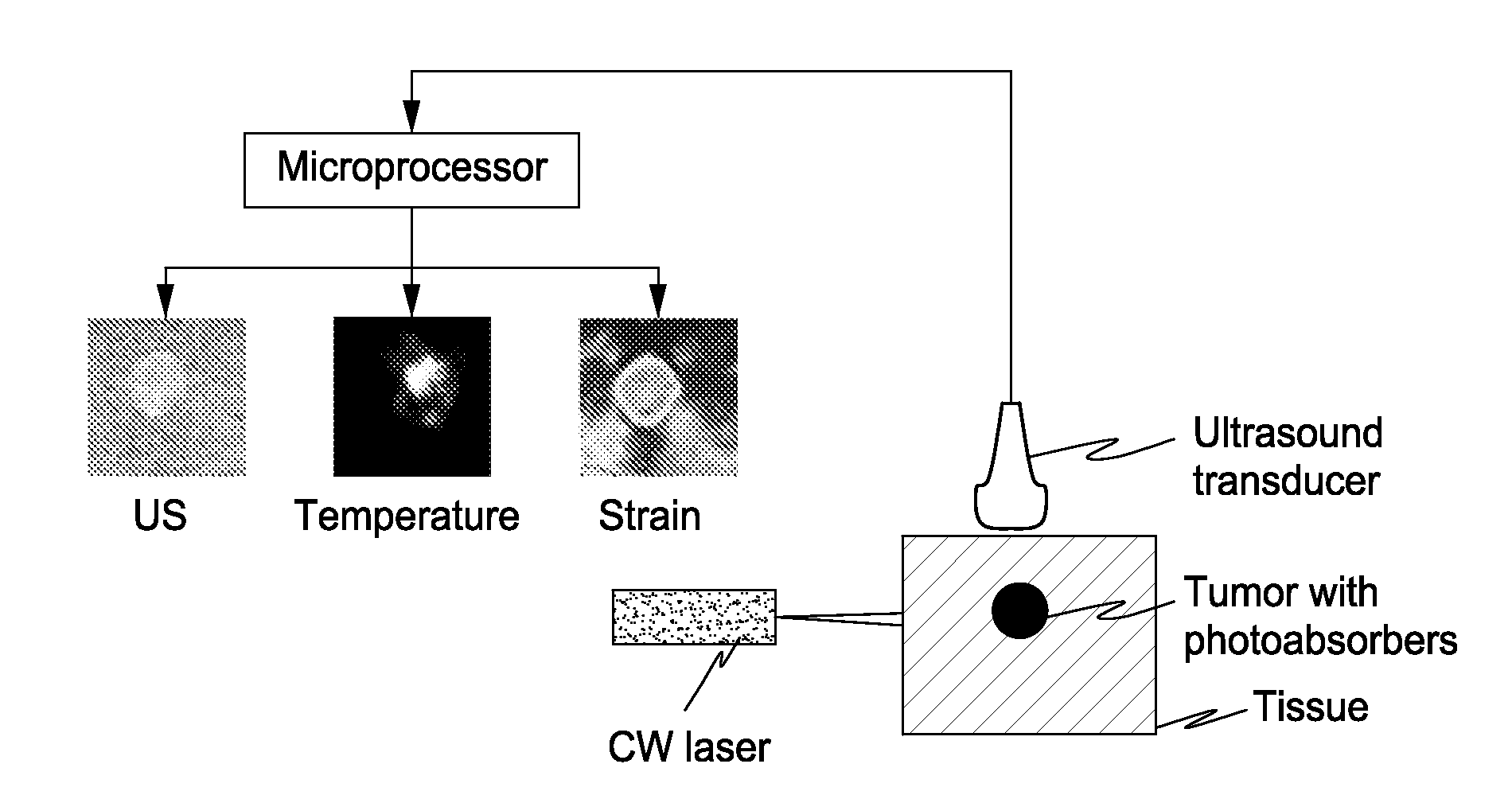 Real-Time Ultrasound Monitoring of Heat-Induced Tissue Interactions