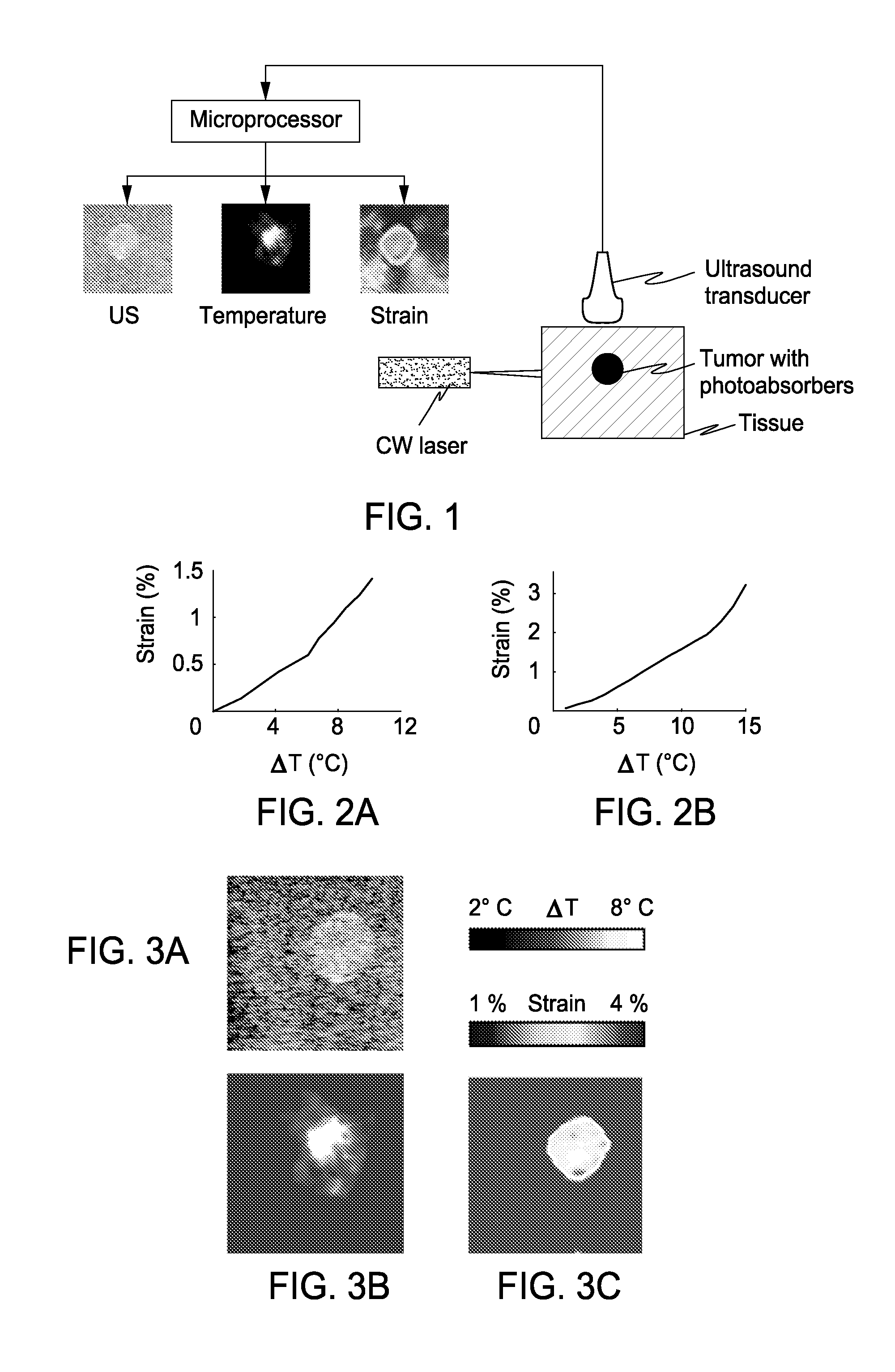 Real-Time Ultrasound Monitoring of Heat-Induced Tissue Interactions