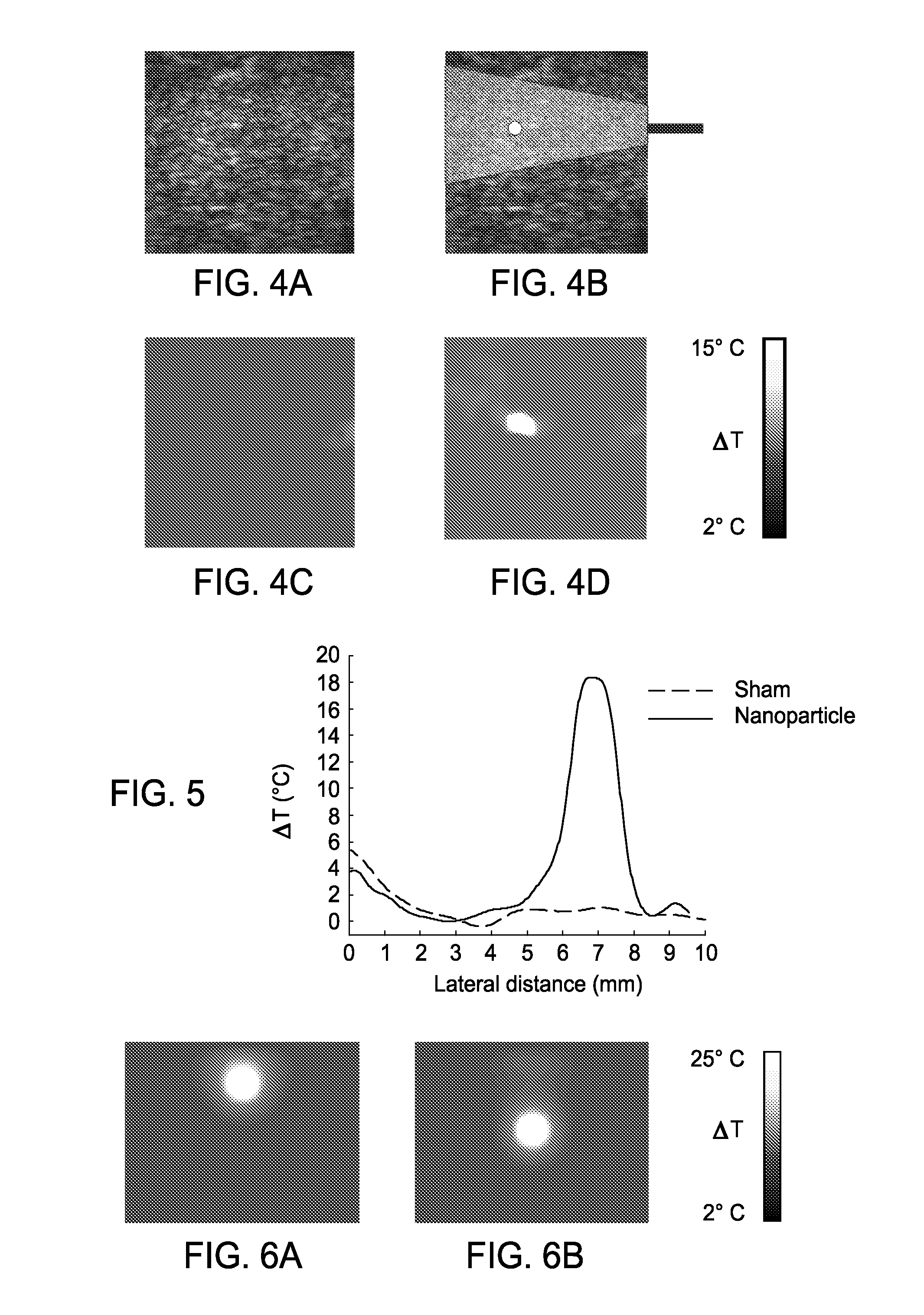 Real-Time Ultrasound Monitoring of Heat-Induced Tissue Interactions