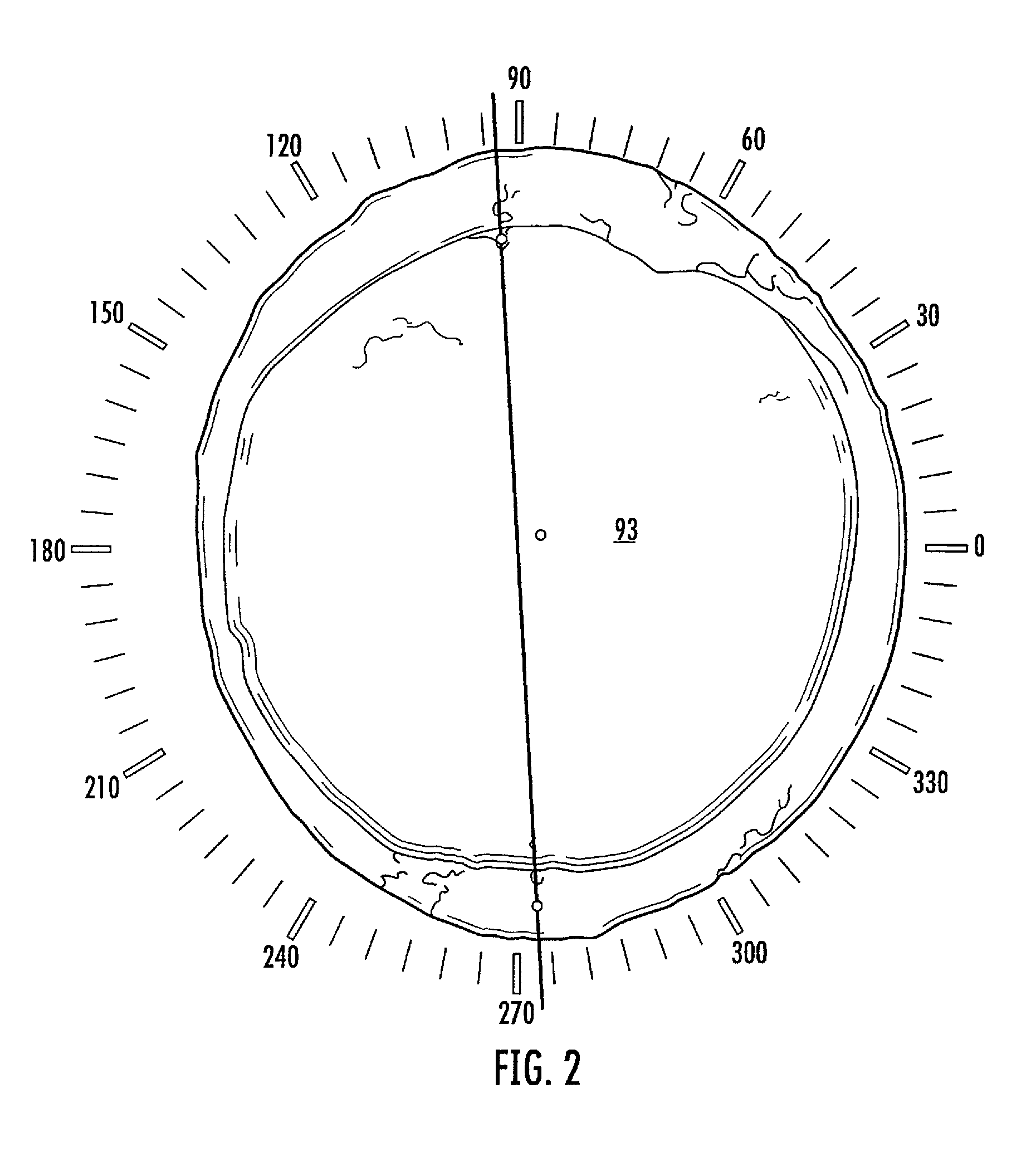 Retro-illumination and eye front surface feature registration for corneal topography and ocular wavefront system