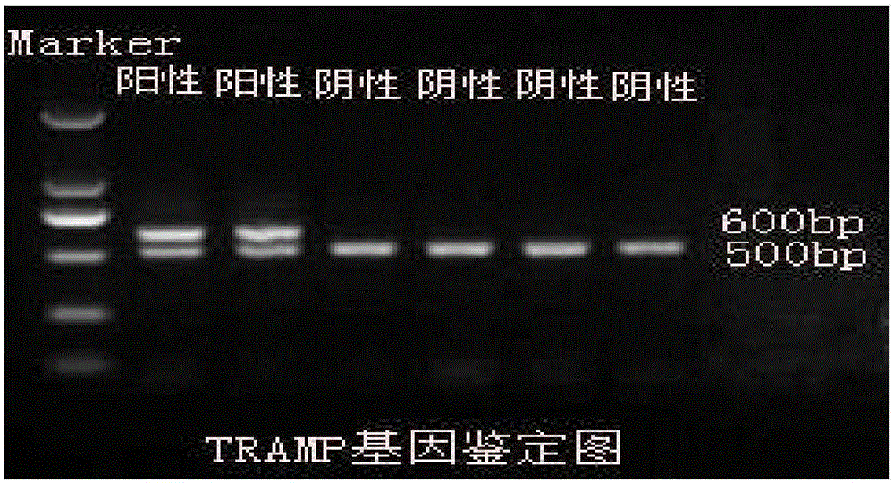 Construction method and application of prostate neuroendocrine carcinoma genetic engineering animal model