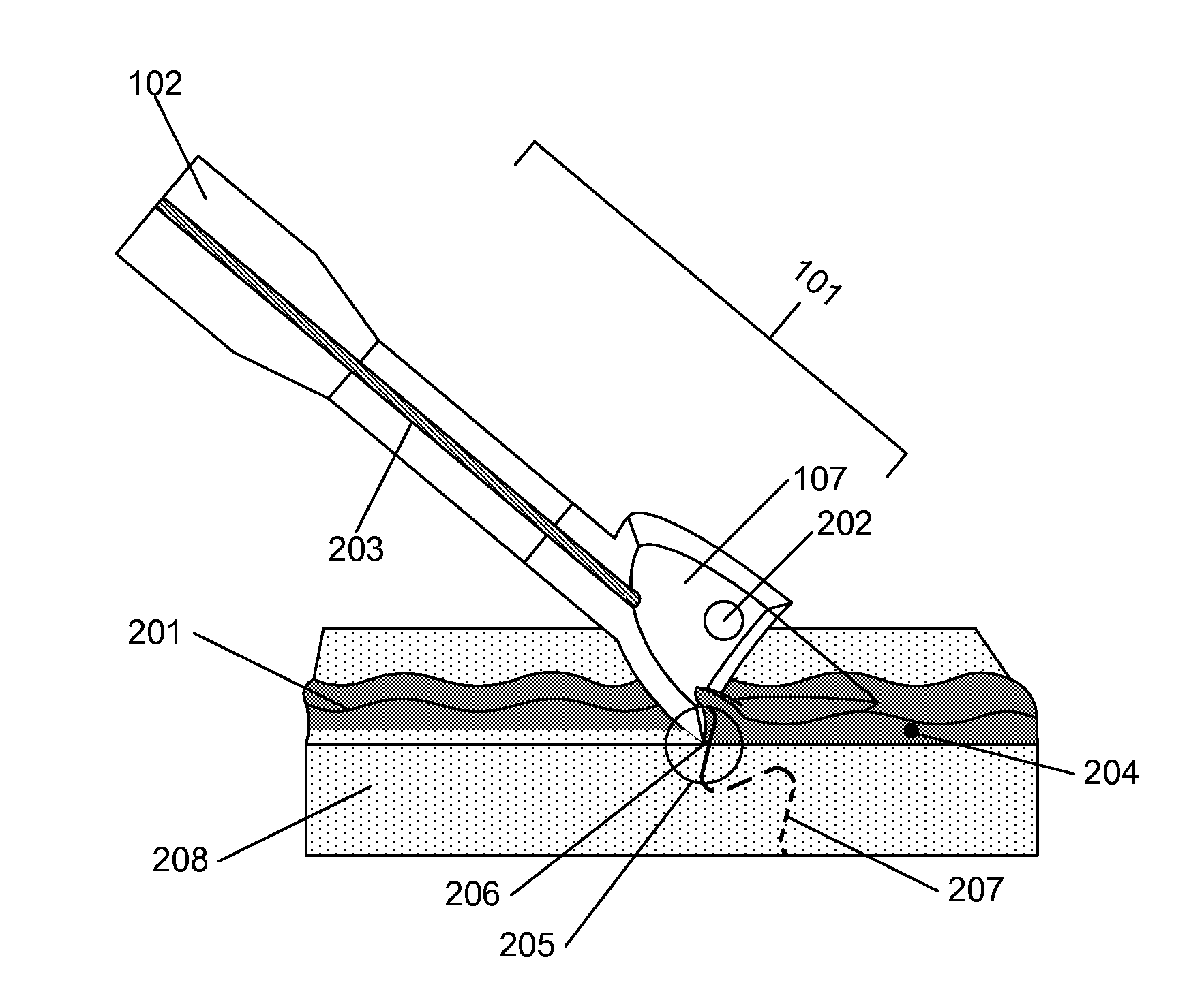 Method for debriding wounds