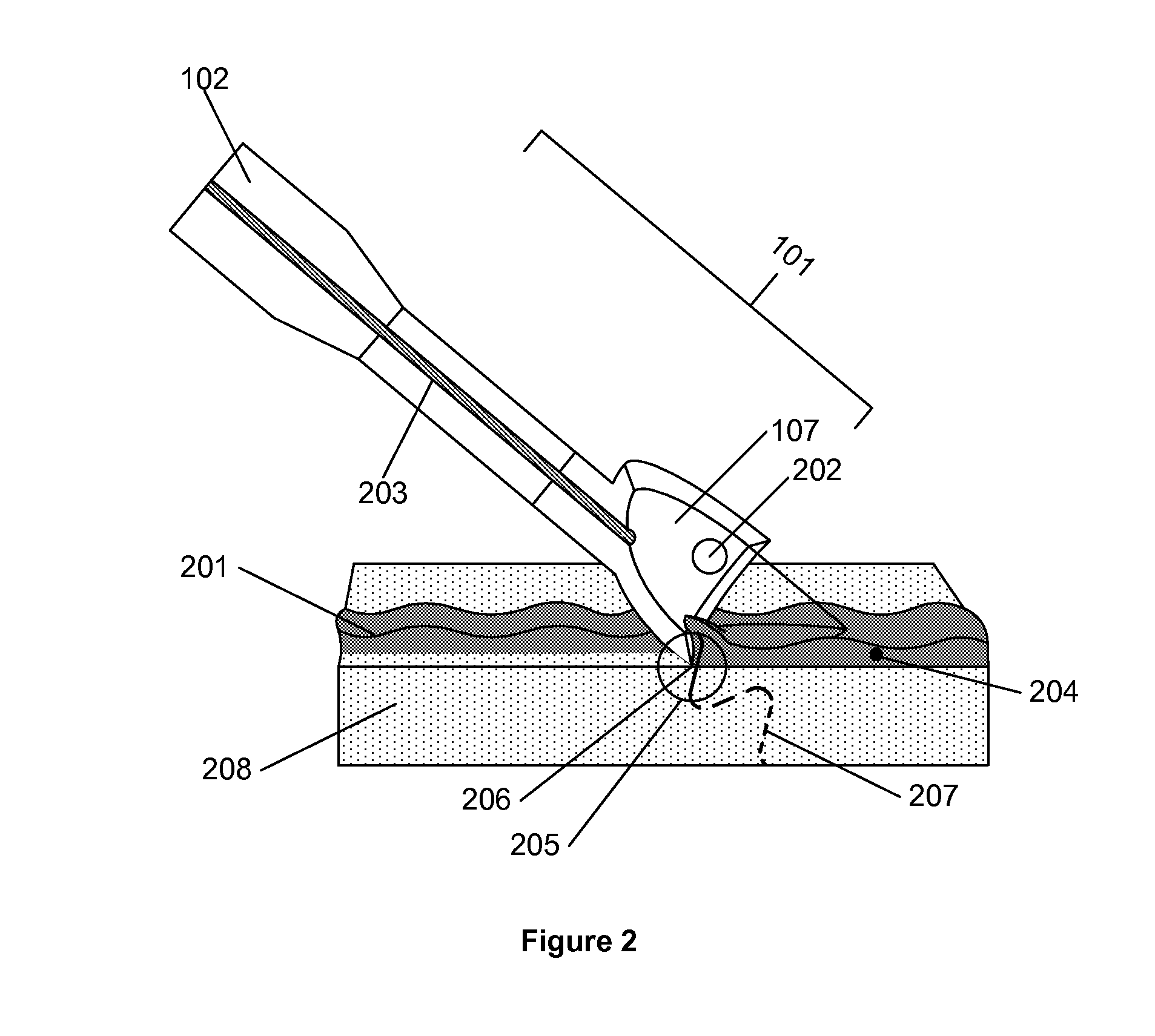 Method for debriding wounds