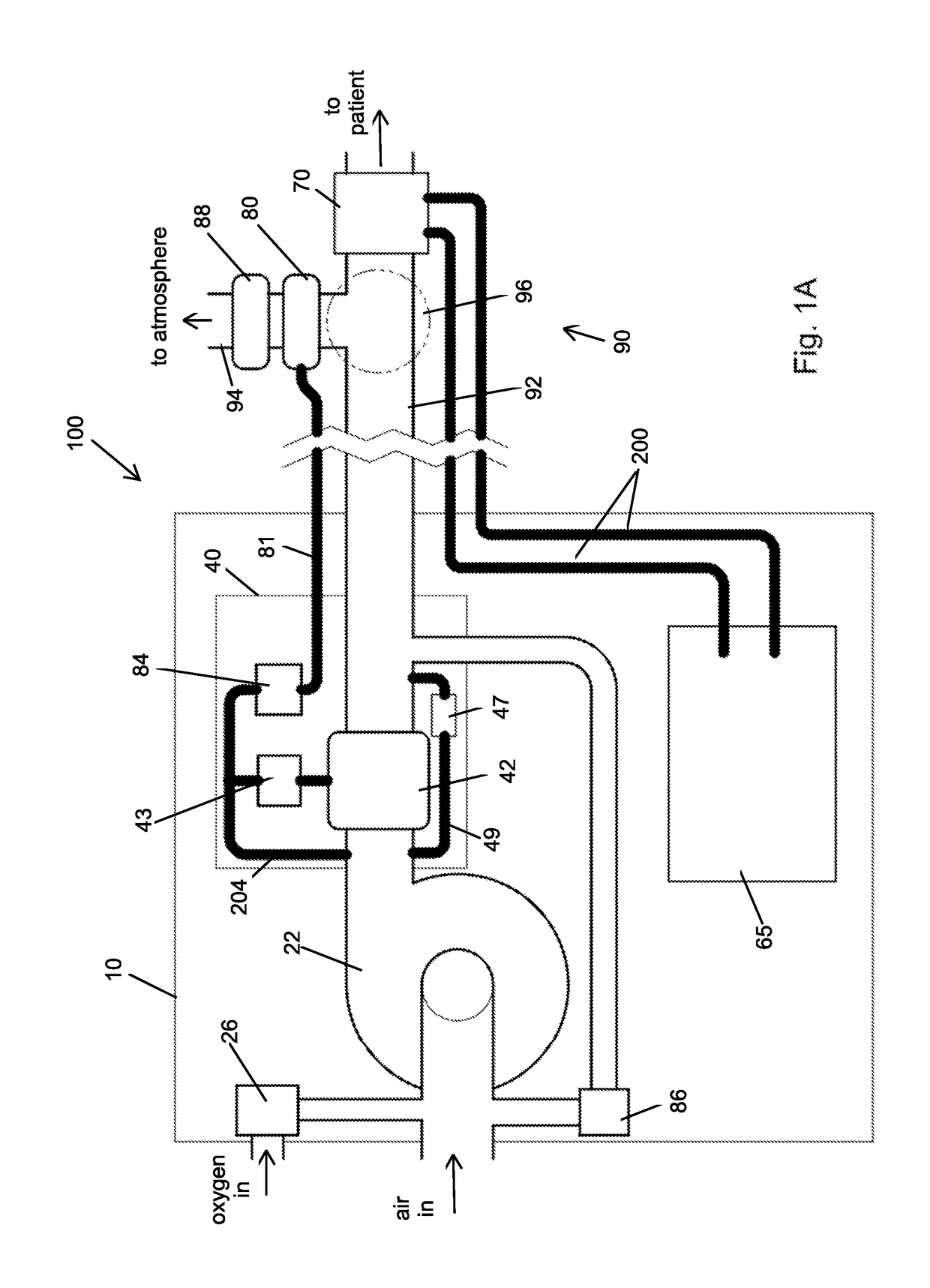 Portable light-weight ventilator system