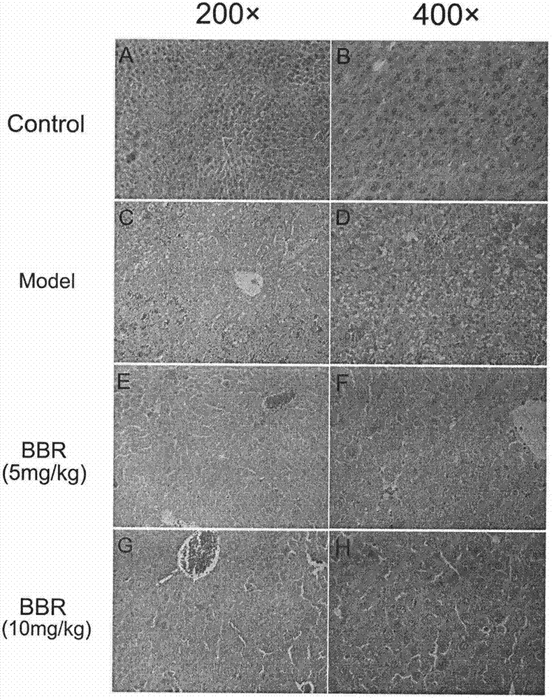 Application of berberine hydrochloride in preparation of medicine used for preventing and/or treating acute hepatic failure