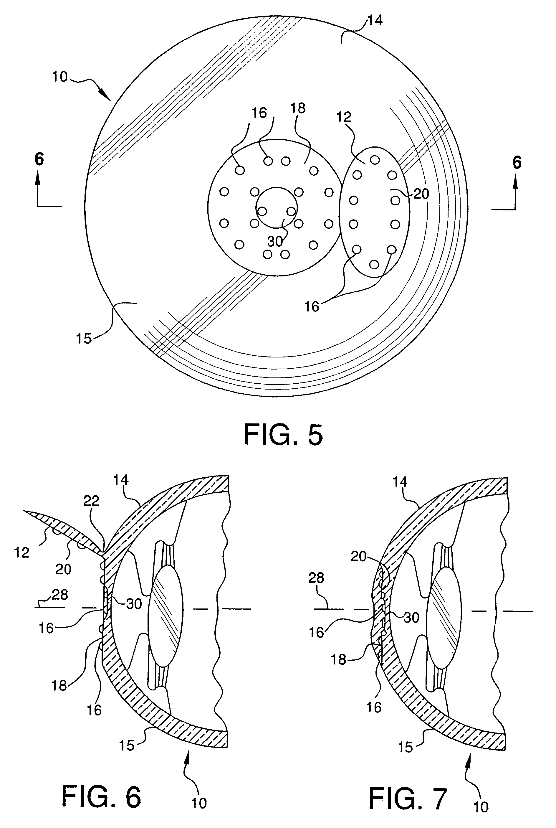 Method for producing a multifocal corneal surface using intracorneal microscopic lenses