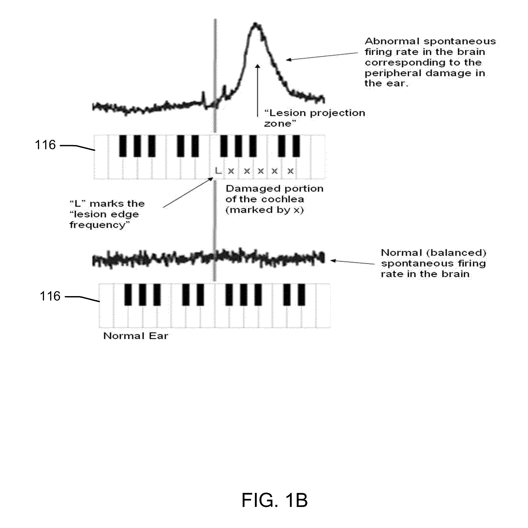 Methods and systems for treating tinnitus