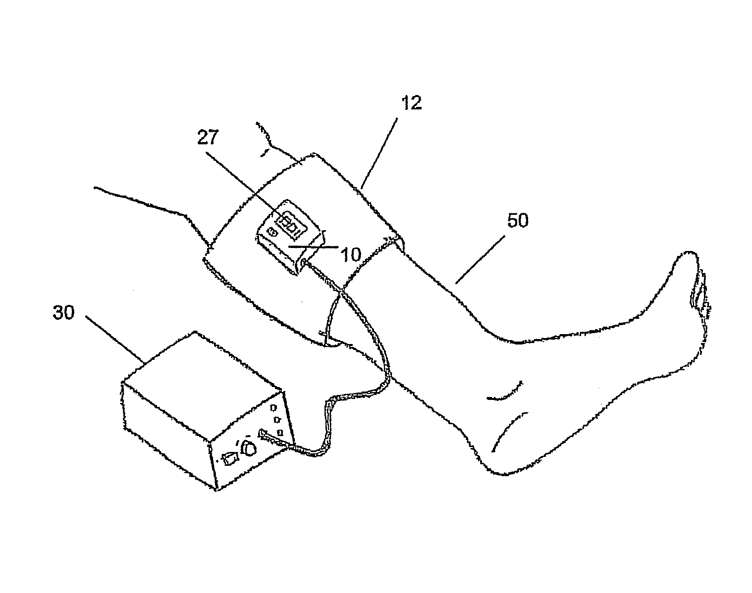 Device and system that identifies cardiovascular insufficiency