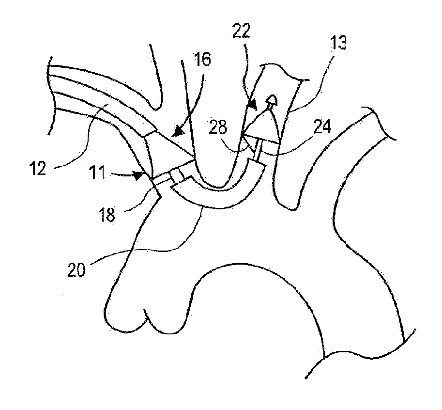 Method of Isolating the Cerebral Circulation During a Cardiac Procedure