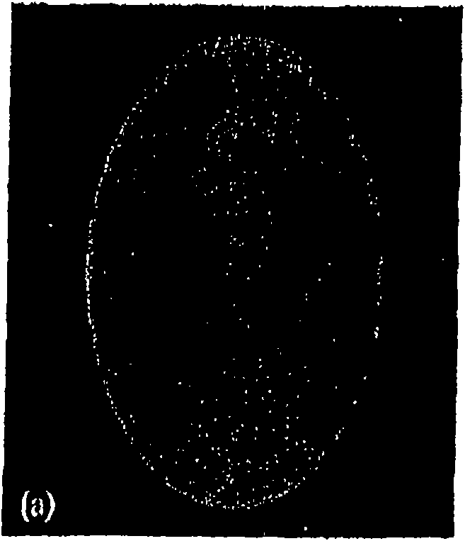 Phase contrast cone-beam CT imaging