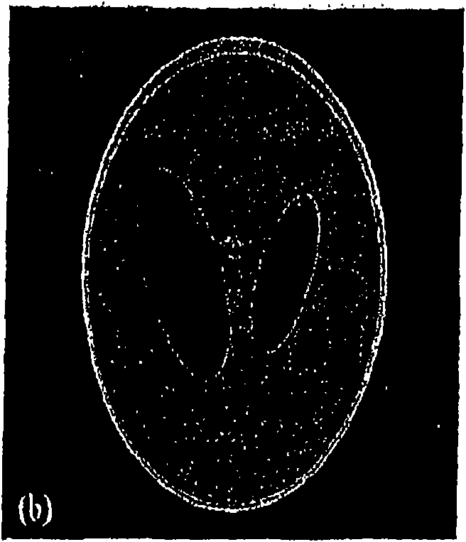 Phase contrast cone-beam CT imaging