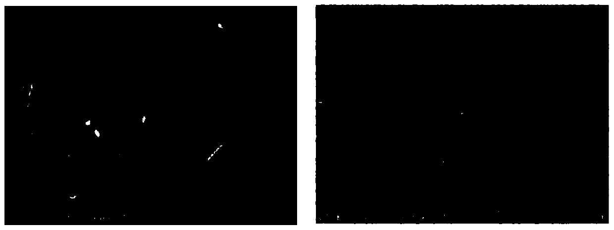 A kind of polylactic acid/β-calcium phosphate/type I collagen composite nerve guide and its preparation method