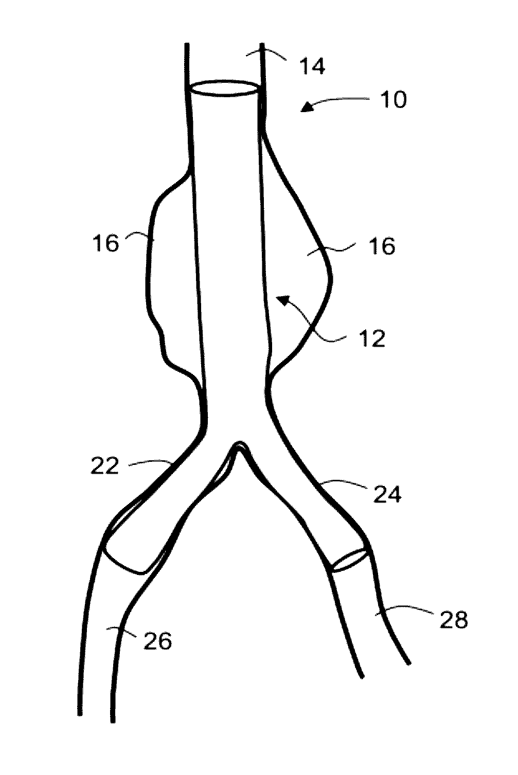 Intraluminal polymeric devices for the treatment of aneurysms