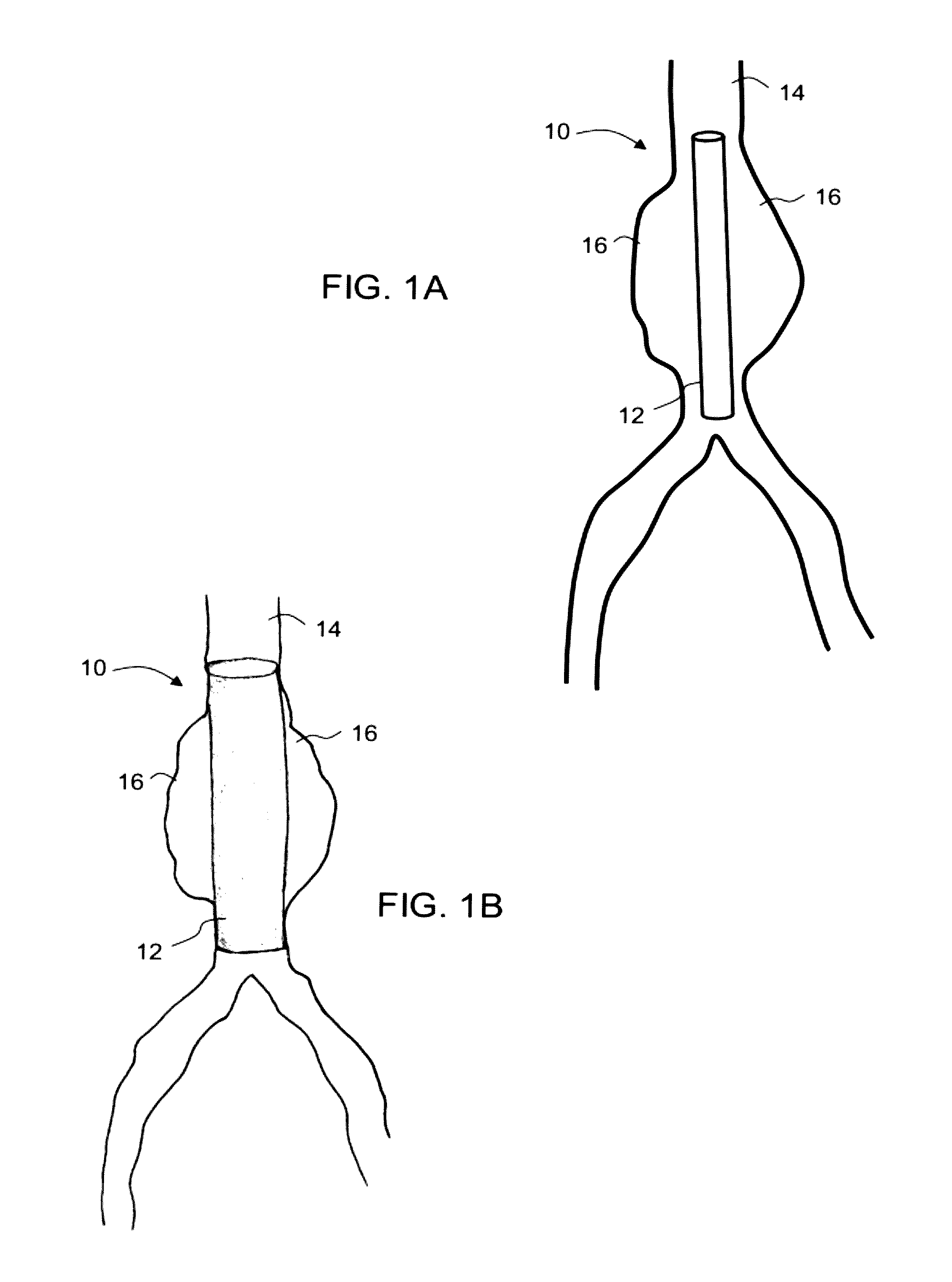 Intraluminal polymeric devices for the treatment of aneurysms