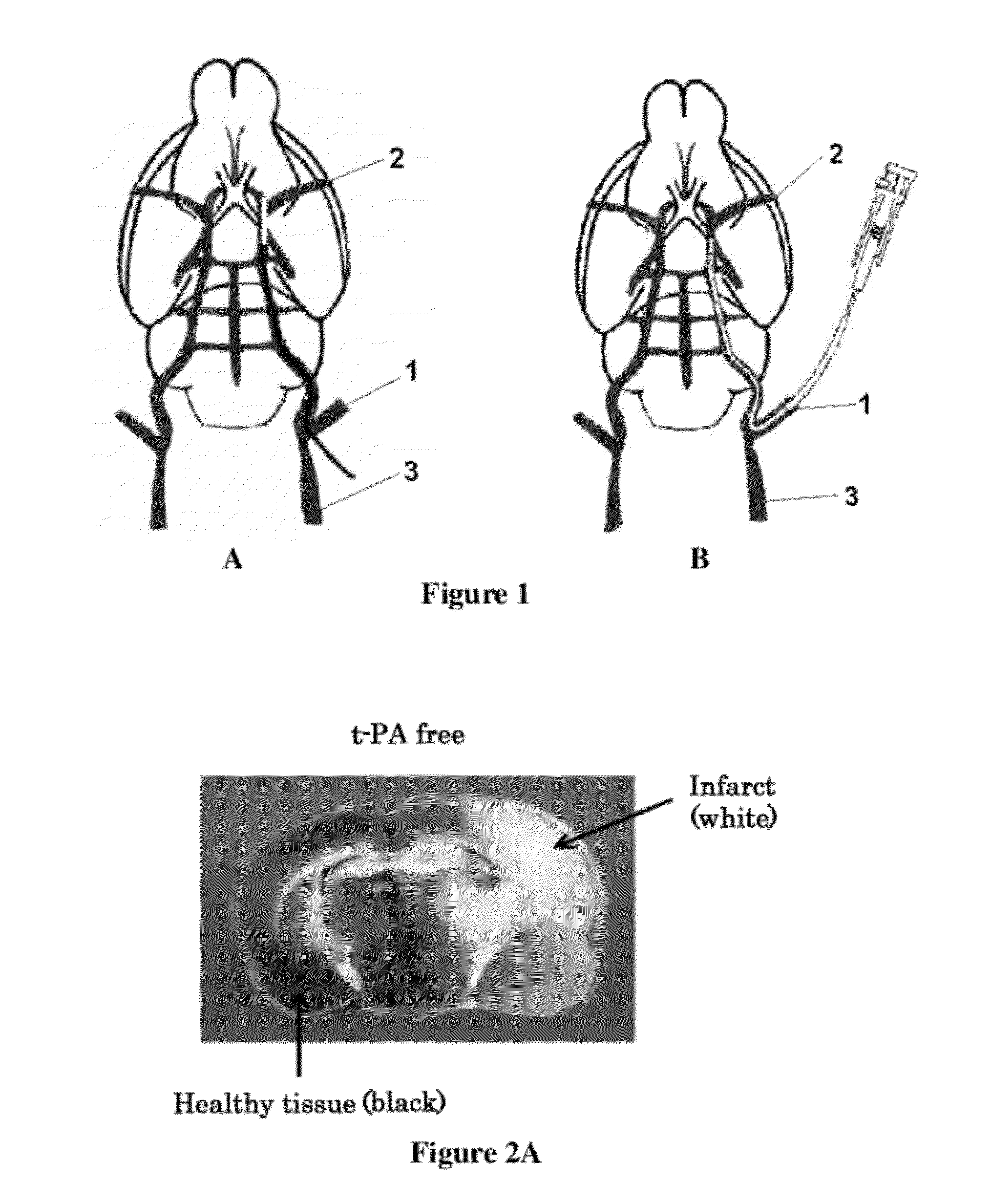 Pharmaceutical composition for treating ischemic events