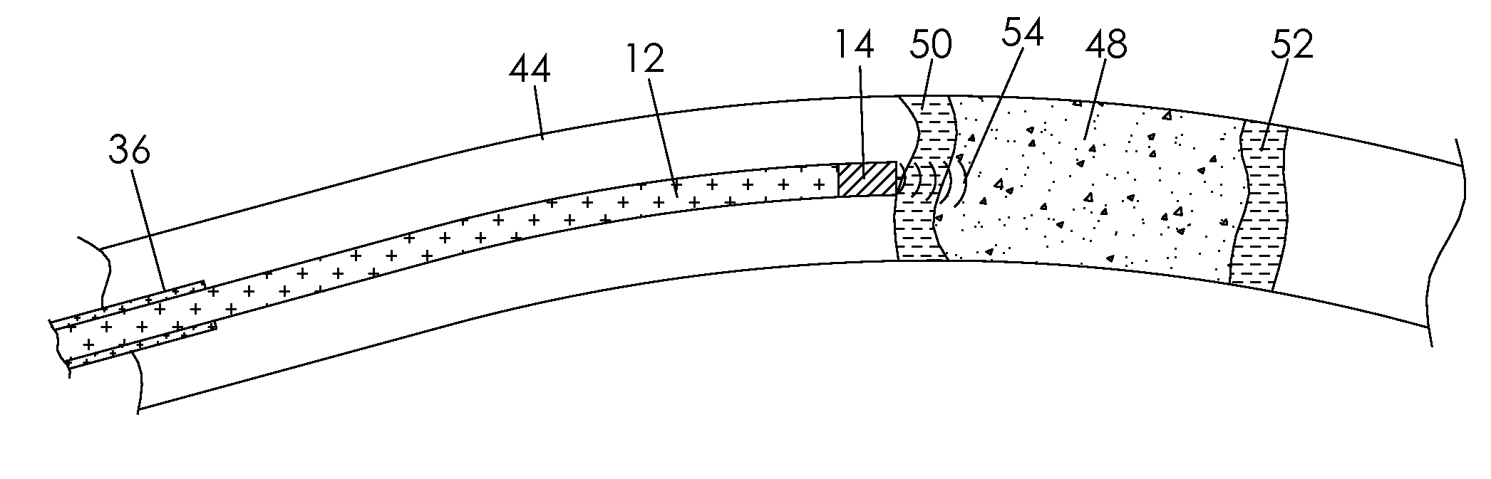 Method and system for assisting a wire guide to cross occluded ducts