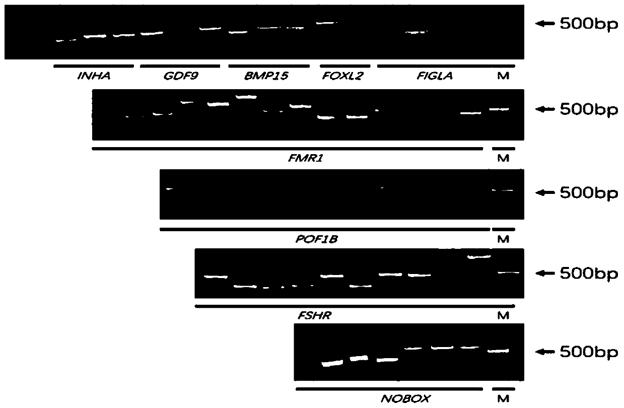 Ovarian premature senility related gene whole exon amplification and detection method