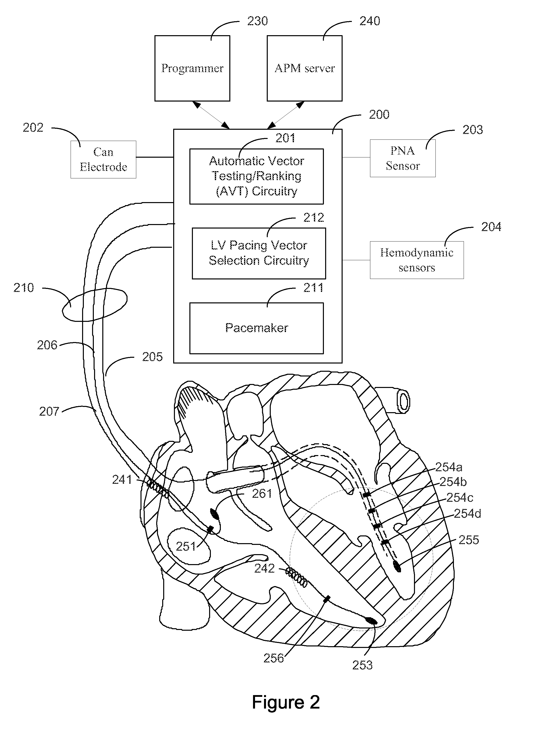 Systems and Methods for Ranking and Selection of Pacing Vectors