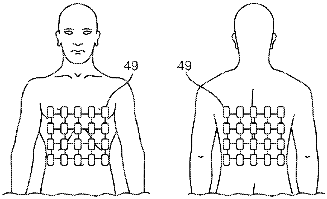 Respiratory volume monitor and ventilator