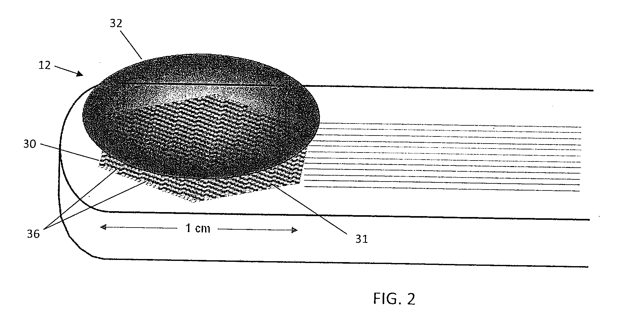 Redistribution Layer in an Ultrasound Diagnostic Imaging Transducer