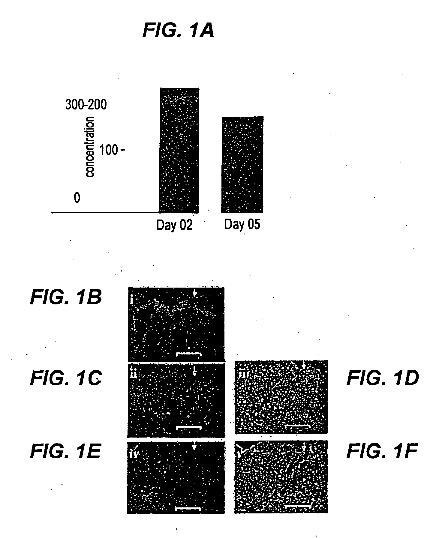 Nutraceutical Treatments for Diabetic and Non-Diabetic Wound Healing