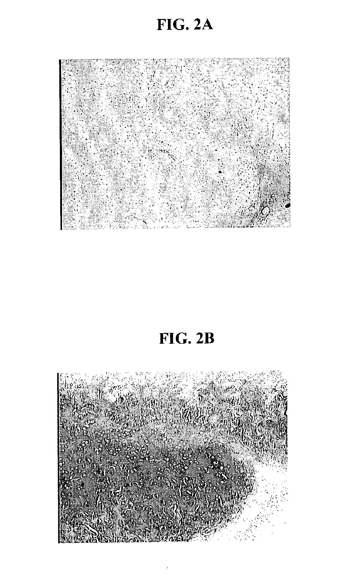 Biocompatible scaffold for ligament or tendon repair