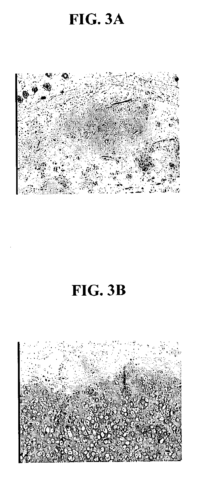 Biocompatible scaffold for ligament or tendon repair