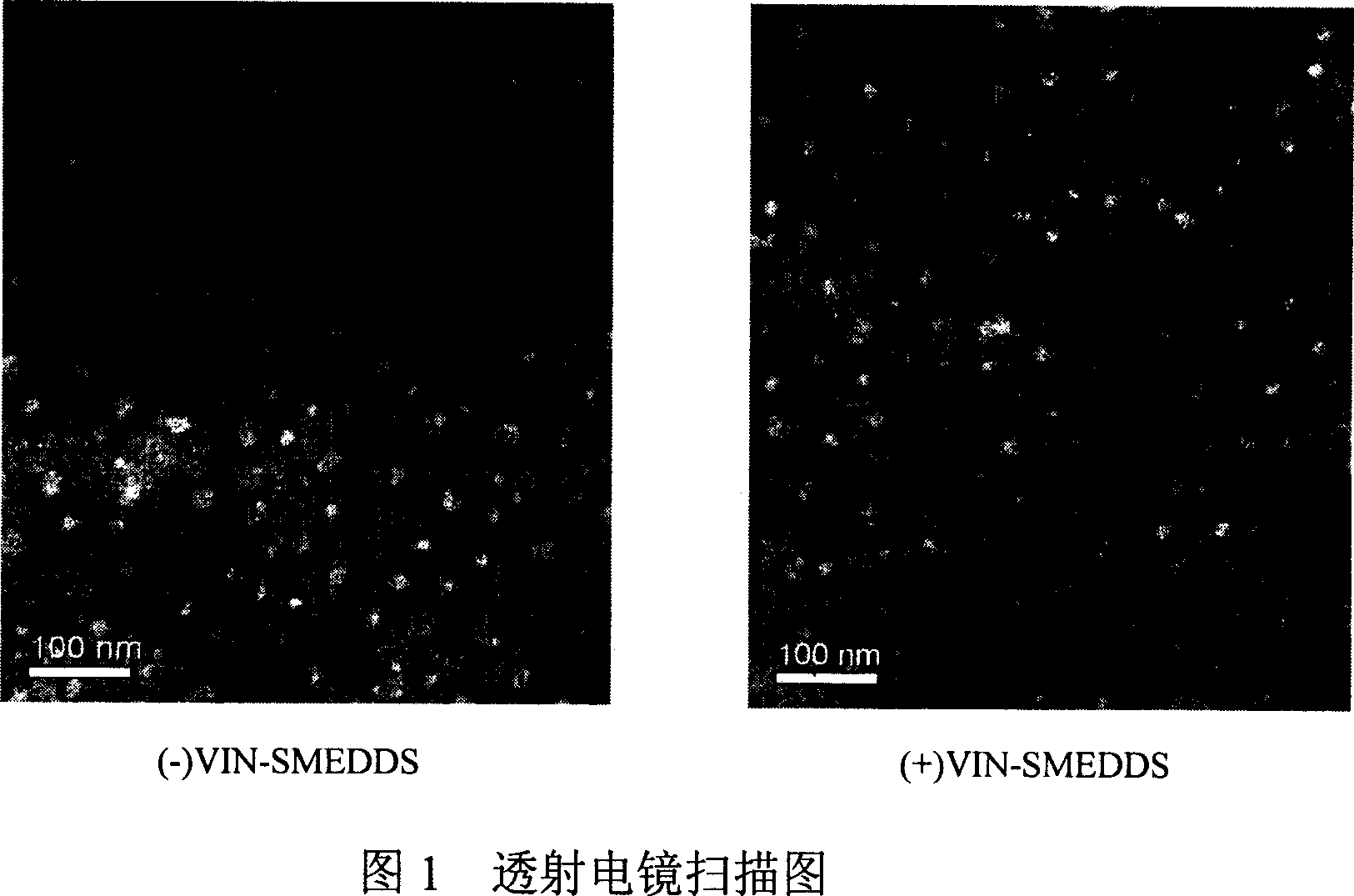 Vinpocetine oral self-micro-emulsification medicine-releasing system and preparation method thereof