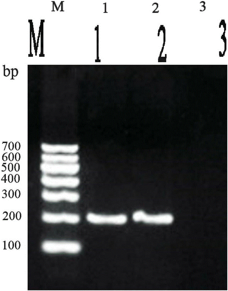 PCR (Polymerase Chain Reaction) assay kit for rana boulenger guenther-infecting staphylococcus aureus and assay method