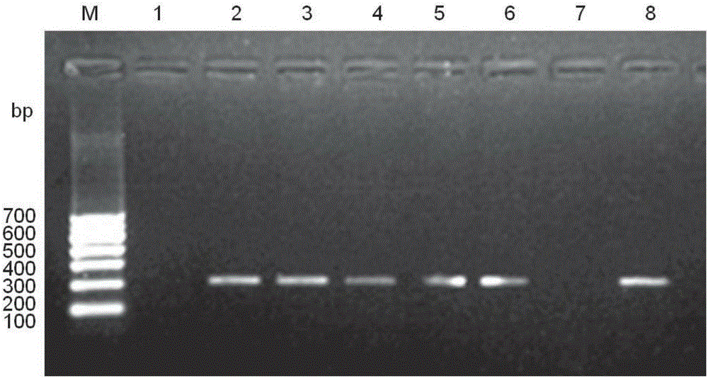 PCR (Polymerase Chain Reaction) assay kit for rana boulenger guenther-infecting staphylococcus aureus and assay method