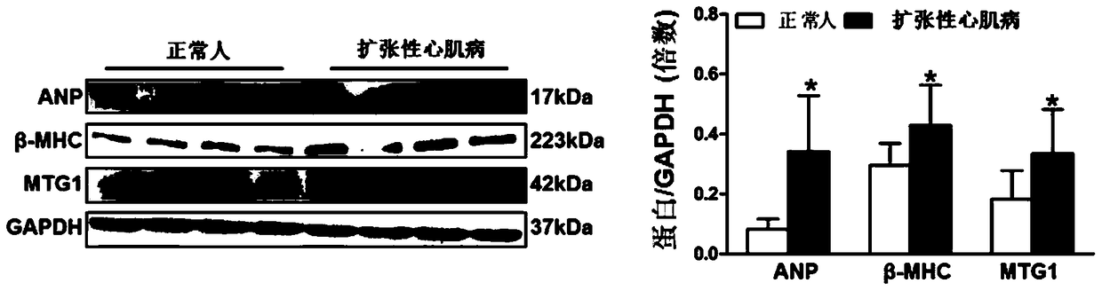 Function and application of mitochondria-associated ribosomal GTPase 1 (MTG1) in the treatment of cardiac hypertrophy