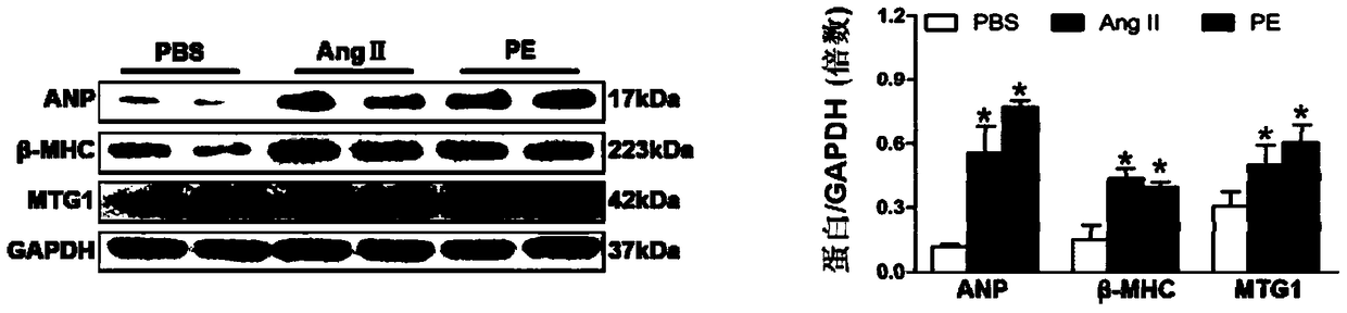 Function and application of mitochondria-associated ribosomal GTPase 1 (MTG1) in the treatment of cardiac hypertrophy