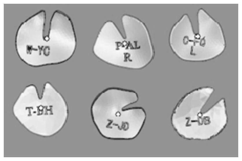 Method for preparing tympanic membrane model and tympanic membrane engraving reference model