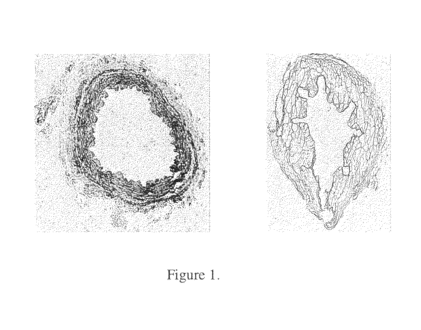 Vascular graft sterilization and decellularization