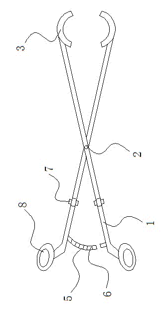 Thighbone lesser trochanter fixator