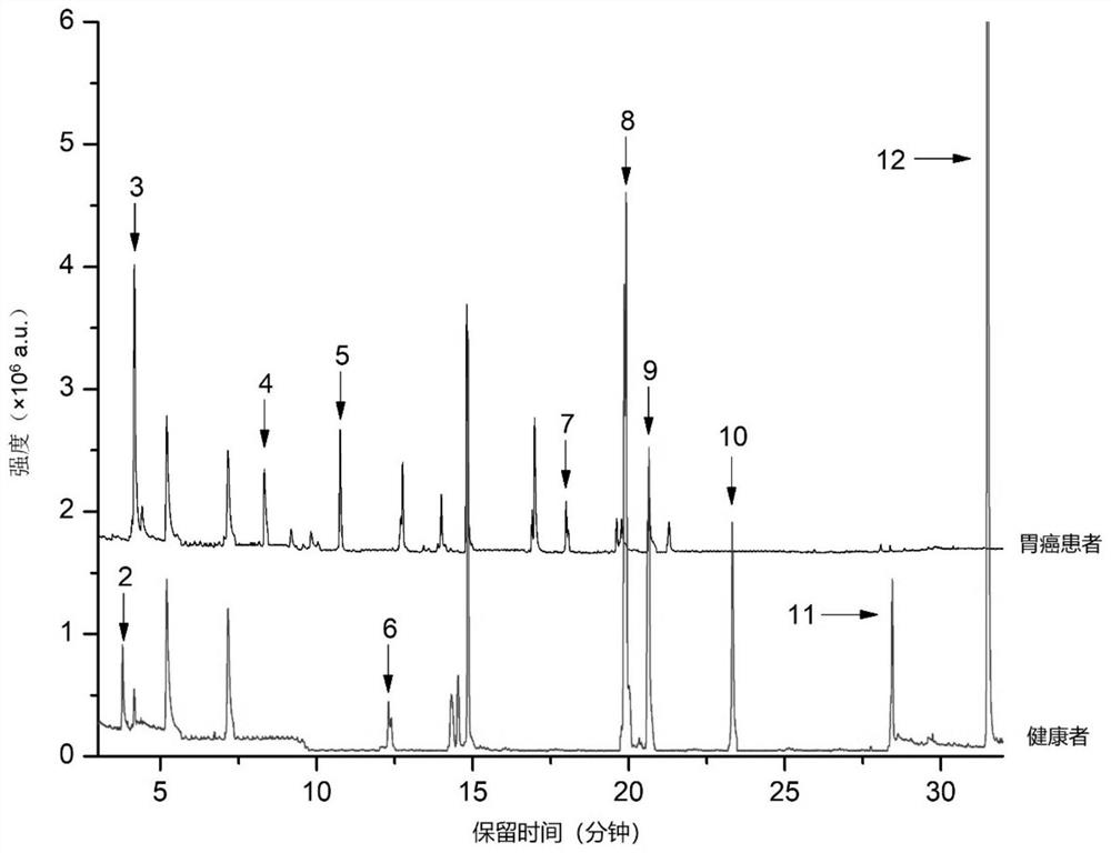 Gastric cancer voc markers in saliva and its application in the preparation of gastric cancer diagnostic reagents